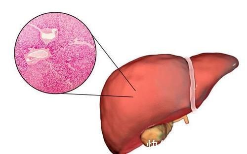 心脏早搏|很多“病”不算病,只是因为年纪大了:这4种疾病,不用过度治疗