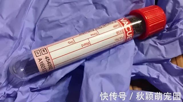 长寿有8个“金标准”!身体健不健康,一看就知道!你达标了吗?