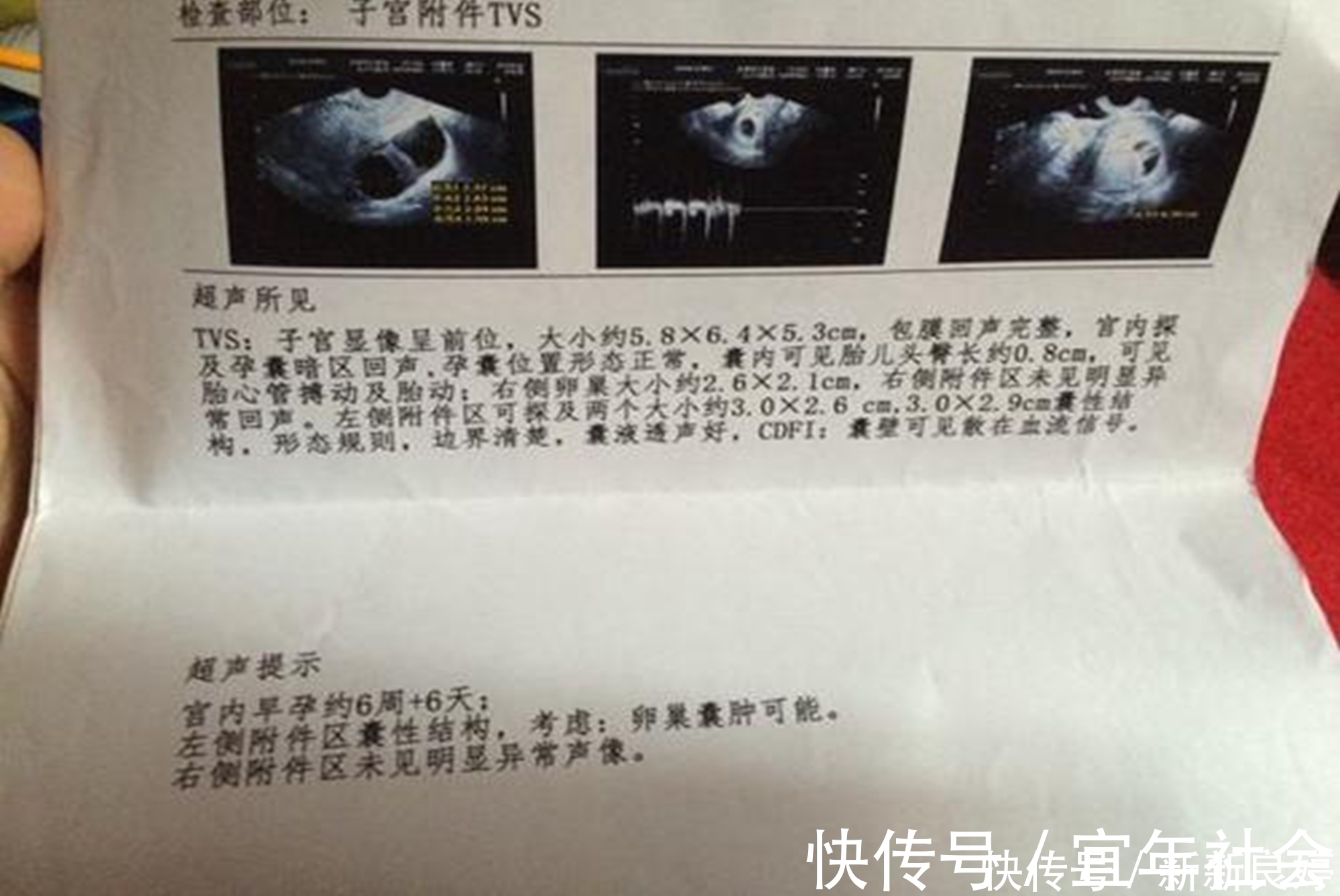孕期|孕期B超单上四个指标,暗示胎儿健康信号,达标孕妈可以放心了