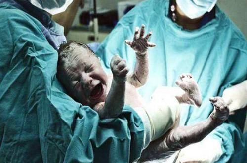 胎盘|羊水栓塞很不“友好”，准妈妈应提前做好预防，这些事要了解