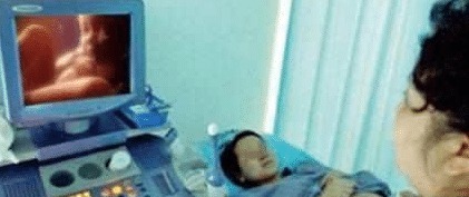 胎停|怀孕第几周最危险 妇产医生 畸形和胎停容易发生在这一周!