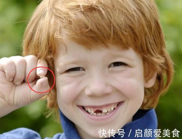 牙齿|儿童换牙顺序图:孩子几岁换?怎么换?一文说清