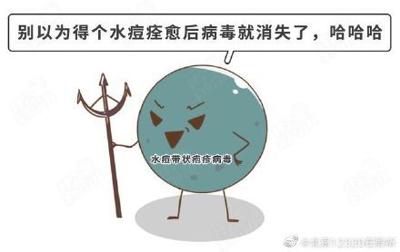 带状疱疹病毒|带状疱疹会传染吗？