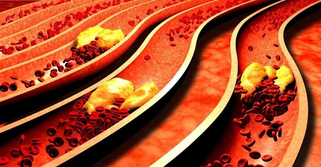 天然溶栓“高手”发现了,日常坚持喝,软化血管,清血管化血栓