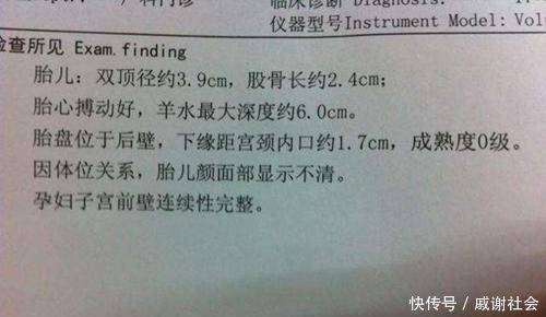 女翻男|产检两次都是女孩,生下的却是男孩,为啥会出现“女翻男”的情况