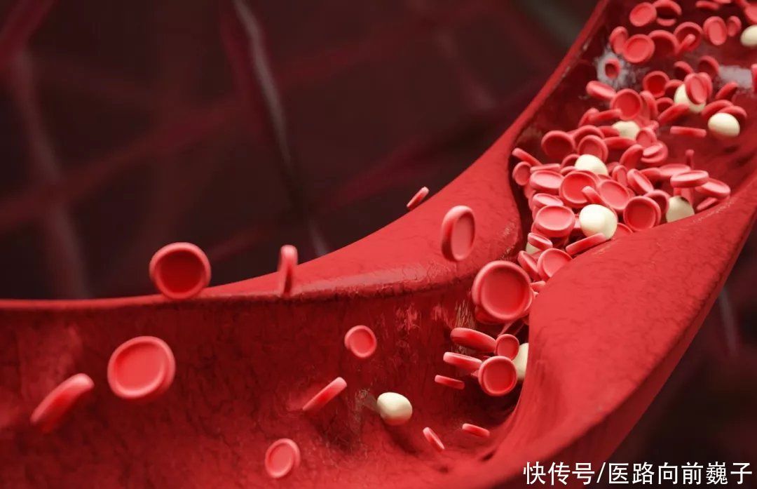 心脑血管病|只因做错一件事,让血管崩溃,脑梗、猝死!中风急救歌转给所有人