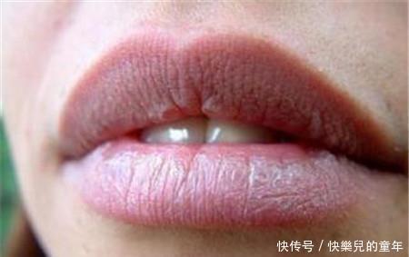 血液粘稠|血液粘稠的人,身体有这4种表现,养血管,谨记饭后“三忌”!