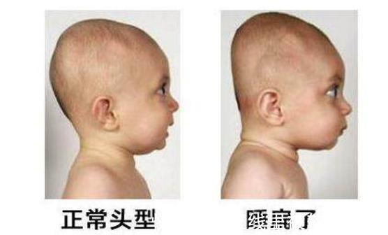 孩子|“睡枕头”和“不睡枕头”的孩子,长大差距很大,父母要多注意