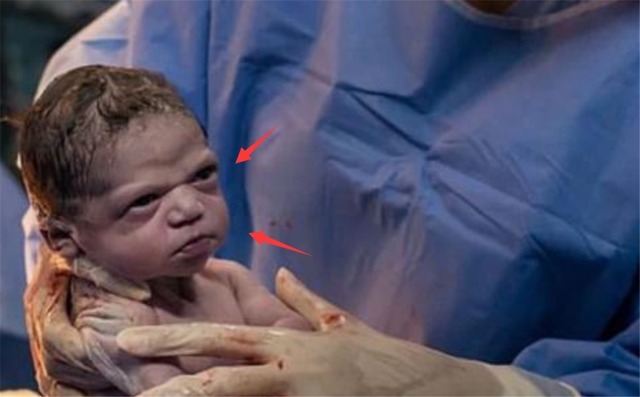 伊丽莎白|“臭脸”女宝宝走红,刚出生就怒瞪亲爹:啥条件啊就敢生我