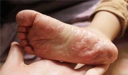 宝宝|新生宝宝出现的这些“症状”,爸妈别急,娃只是长得有点儿快