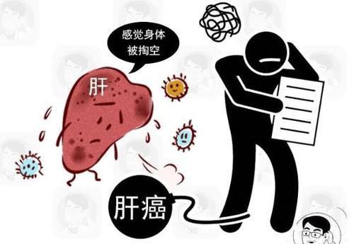 癌变|近期右肩膀莫名疼痛,可能是癌症发出的信号,当心肝癌来报道