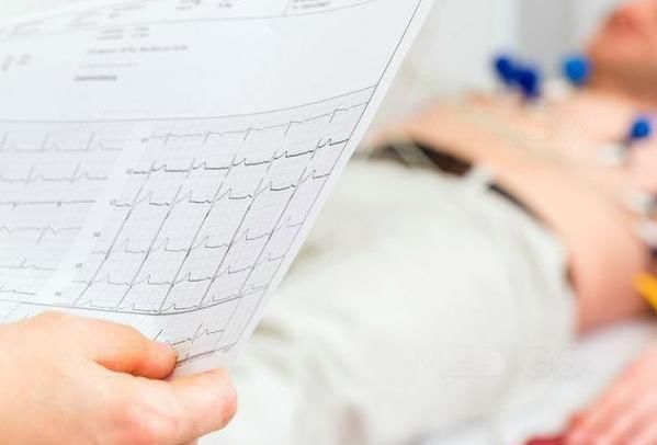 高血压|只是血压很高,但医生要求我做四项检查,以前不明白,现在知道了