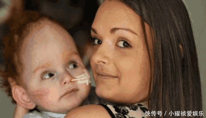 大脑|国外男婴出生没大脑, 医生说活不了几天, 现在已2岁会喊妈妈