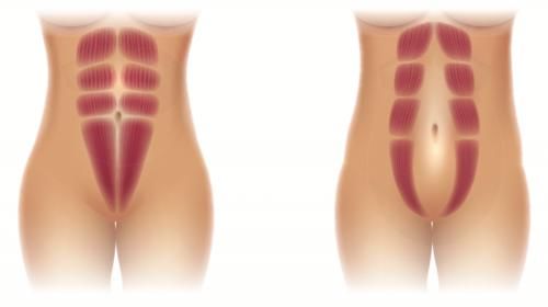 为什么生完宝宝后肚子还是很大?一张图告诉你真相