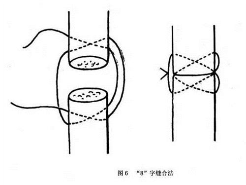 告诉|武侠小说中挑断手筋和脚筋是怎么回事?还有救吗?医生告诉你答案