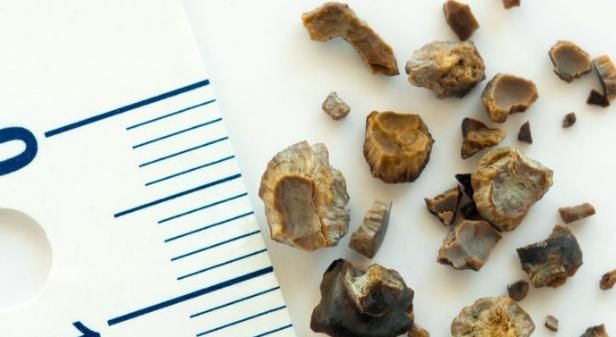 胃黏膜|早餐“4大忌”，不然不仅白吃还伤了健康，若做到5个1营养又健康