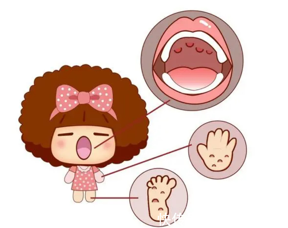 宝宝|原本以为夏季才是手足口病的高发期,没想到冬季也是