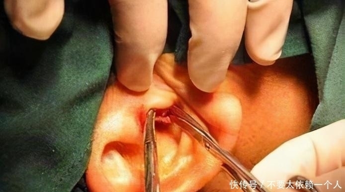 小男孩|孩子生下来就没掏过耳朵,又长又宽的耳屎堵住耳道,家长需警惕