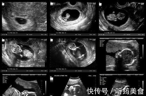 医院|每次产检结果正常,孩子生出后发现畸形,医院需要负责吗?