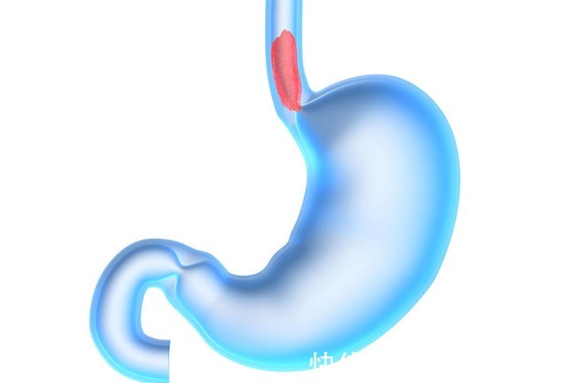 是真的吗|有胃病不能吃西红柿医生提醒若想养胃,尽量少吃3种“素菜”