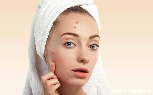 红霉素眼膏|2块钱一支的红霉素软膏，居然还有这3个功效，知道的人少之又少