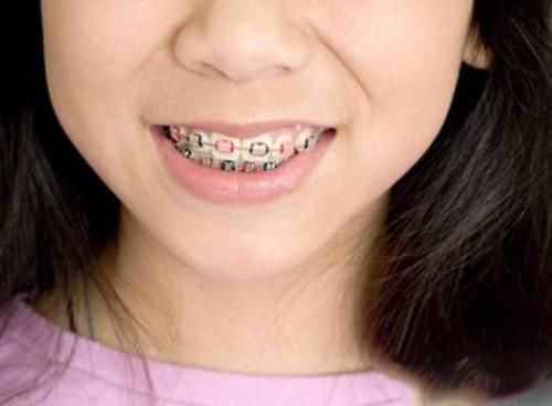 医生|为何多数医生不建议做核磁共振?或许很多人还不知道,了解一下