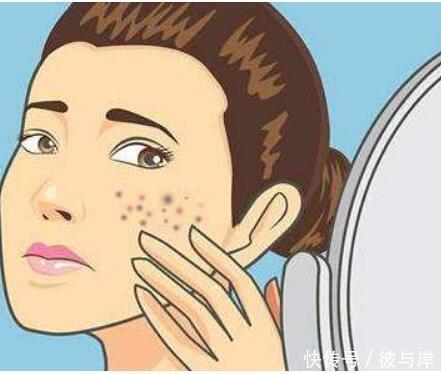 形象|痘印真的很影响形象?别乱用去痘印妙招,3个科学方法不妨试一下