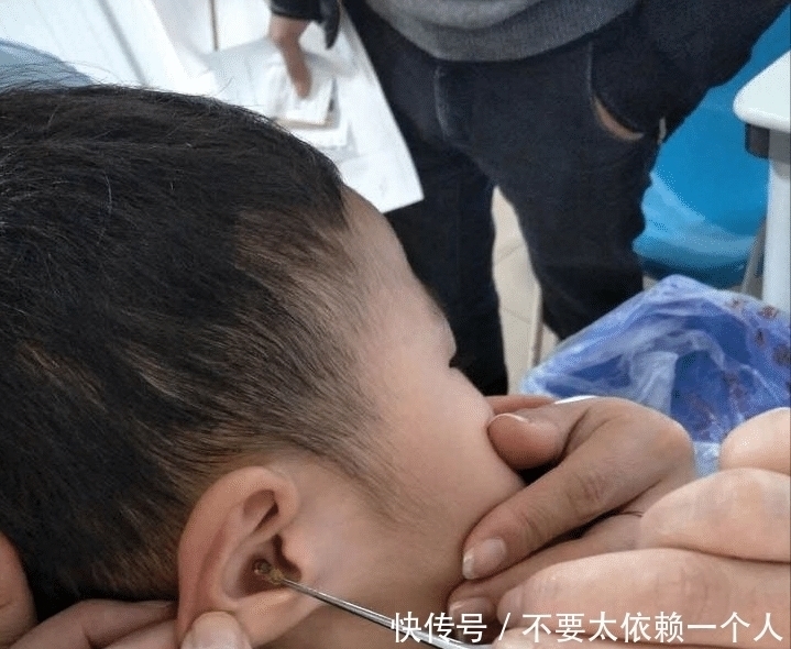 小男孩|孩子生下来就没掏过耳朵，又长又宽的耳屎堵住耳道，家长需警惕