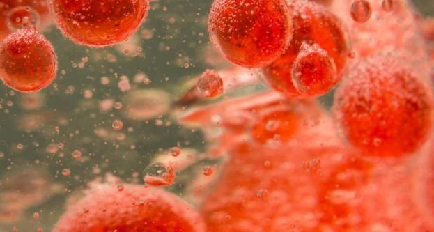 降血脂的“冠军”找到了,搭配水一起喝,血管干净、血脂降下来了