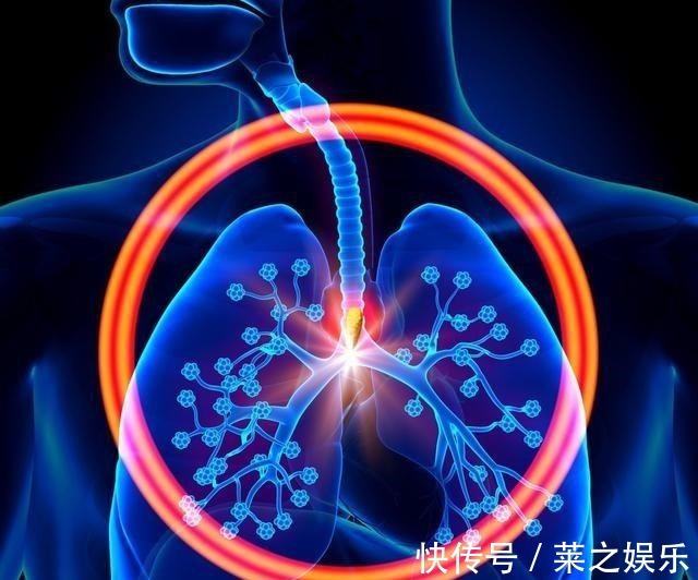 小细胞肺癌|肺癌细胞全身跑,皮肤下出现“疙瘩”需当心,转移到皮下也是晚期