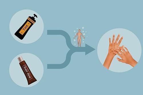 乳癌 染发对身体健康到底有影响吗?染发时最好做到3点,或可放心染发