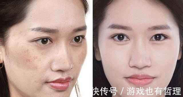 护肤|脸上长斑难看,朋友用香菜水洗脸,轻松告别了色斑脸,我是真服了!