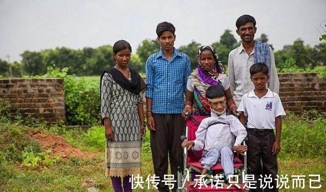 利瓦|男孩头部怪异,只能挂在胸前,手术7个月后的模样让人感动到哭!