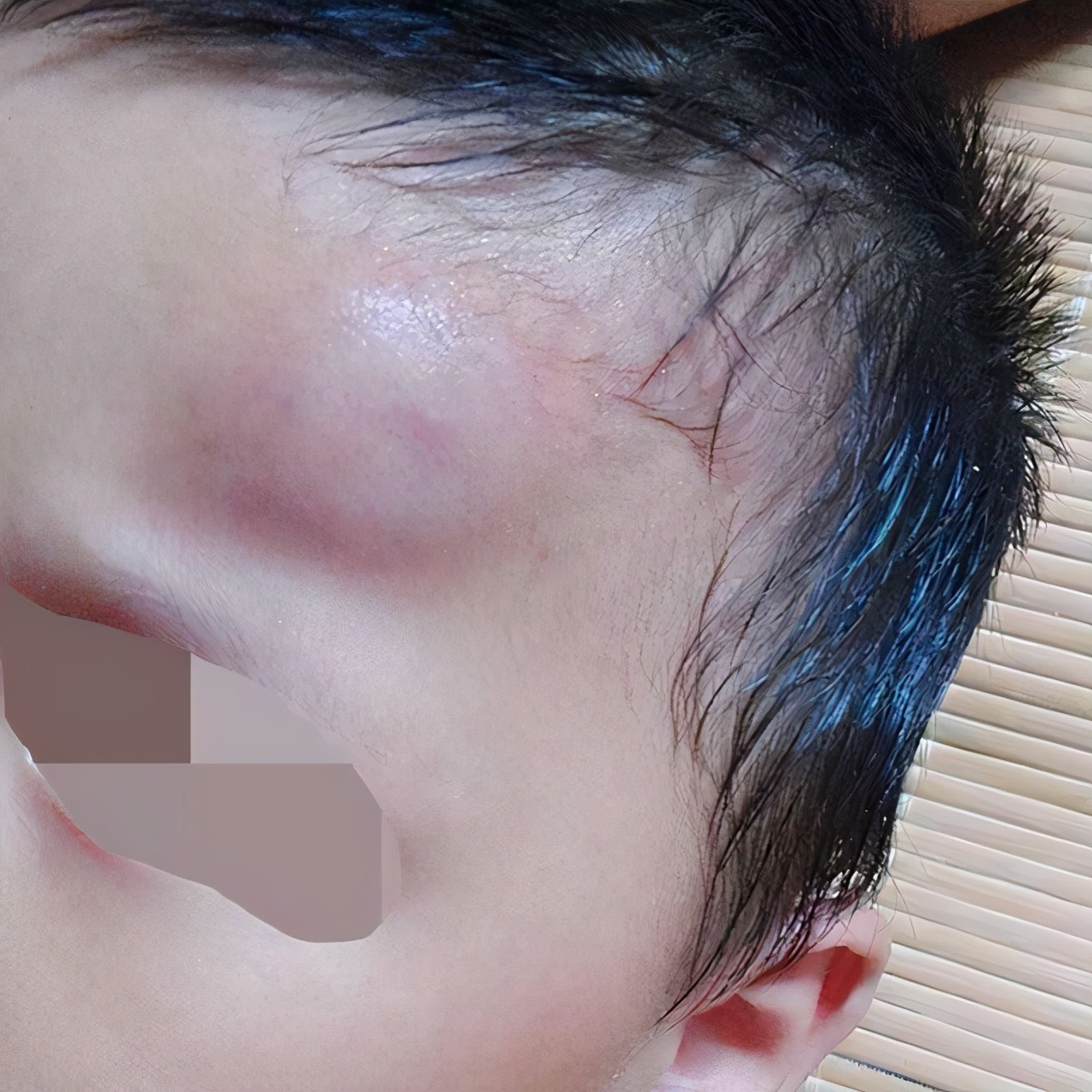 家长|孩子不小心摔下床,妈妈一个错误举动,反倒给孩子带来更大的伤害