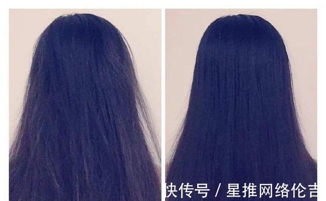 头皮|“无硅油”的洗发水更好?选哪款洗发水,头皮和发质说了算!