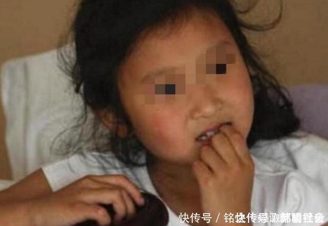 专家|从小“咬指甲”的孩子,长大后怎么样了专家逃不掉2种结局