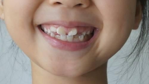 高颜值|想让娃有高颜值,从小做到五件事,越长越好看