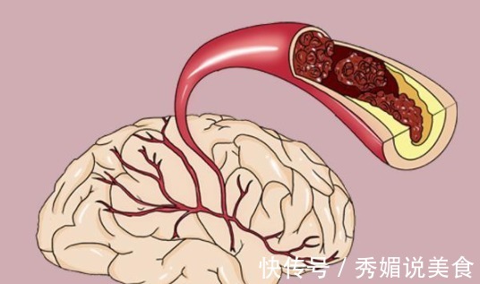 糖尿病|有糖尿病的人要远离豆腐提醒不想血糖升高,这3种素食要少吃