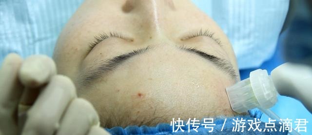 大坑 8年花20万+才摸清的医美护肤大坑!