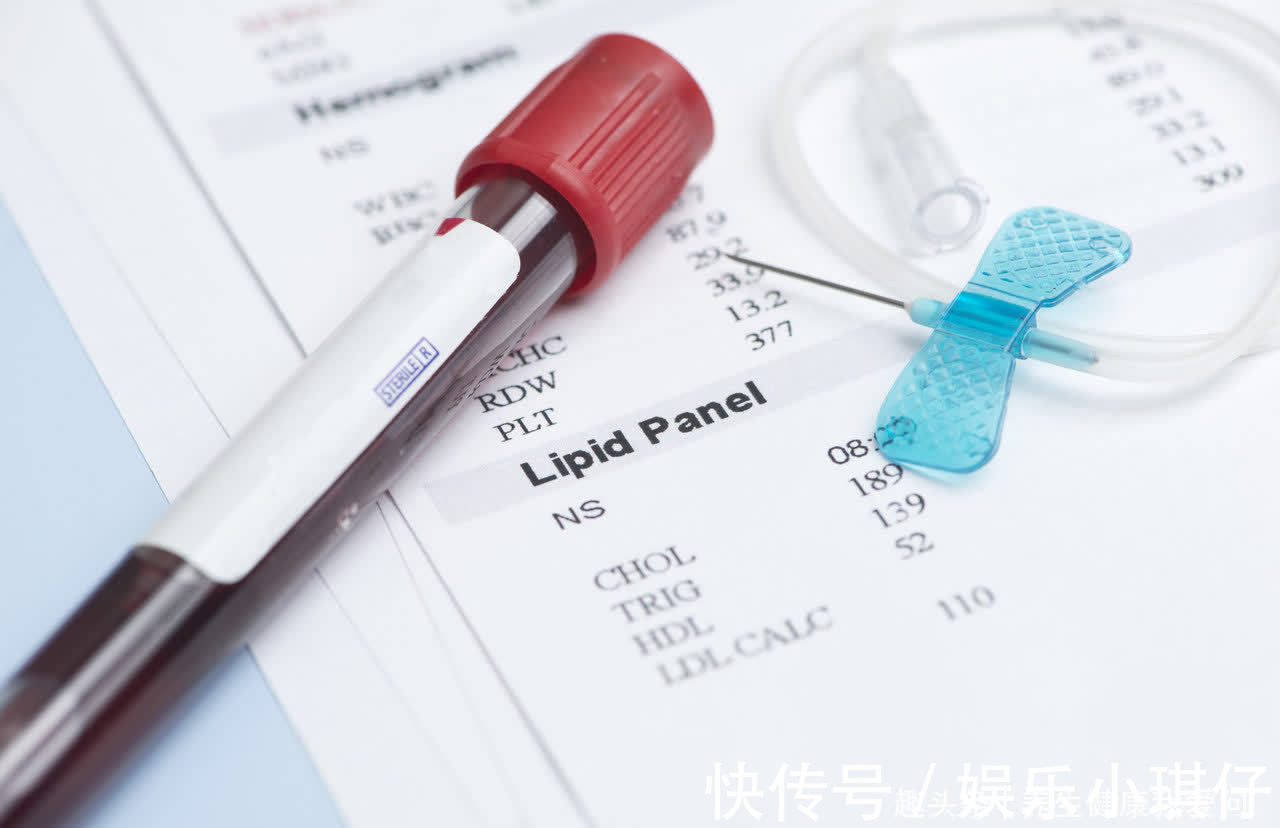 指南|醋是血管清道夫，促消化还是软化血管？提醒：4种食物，最毁血管