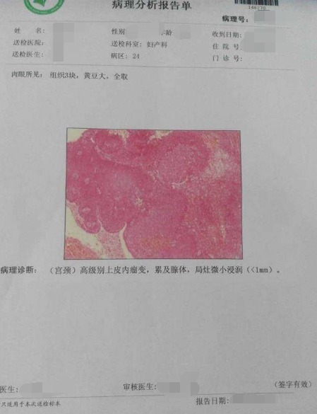 转阴|女性患上宫颈癌，身体有3处地方不会说谎，却很容易被女性忽视！