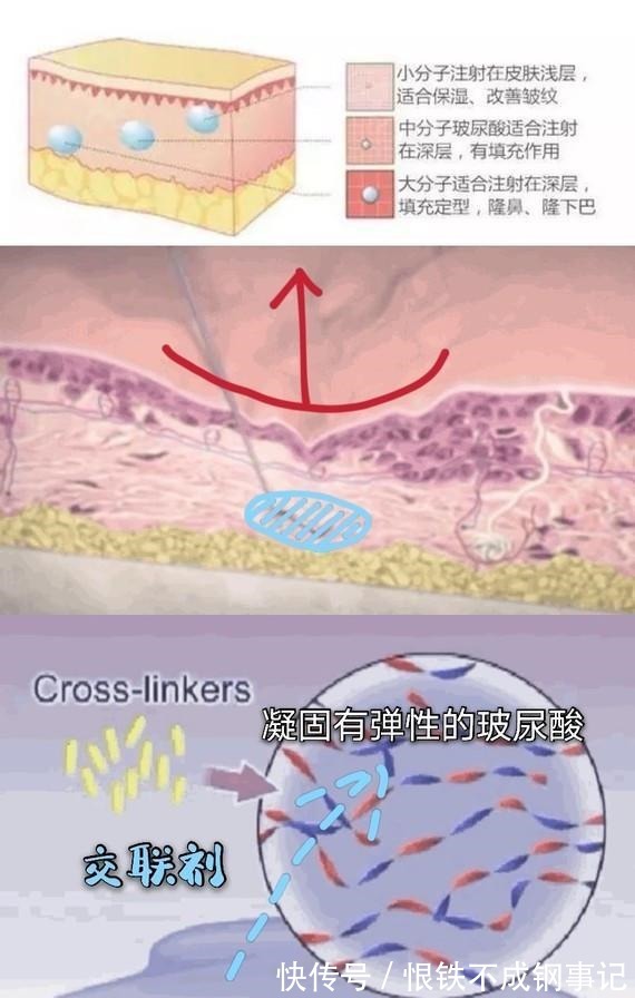 伊婉 玻尿酸的前生今世！护肤、口服、医美，竟然连TT里面都有添加！