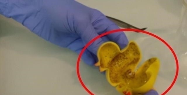 男孩|洗澡鸭险致男孩双目失明,这类网红玩具一定要经常更换,父母注意