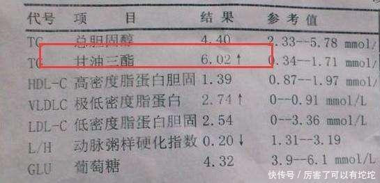 原因|1种零食,正在偷偷“堵住”你的血管,医生提醒:40岁后要少吃