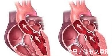 视网膜|有高血压却不管不顾,5大并发症悄然腐蚀你的身体!有症状就迟了