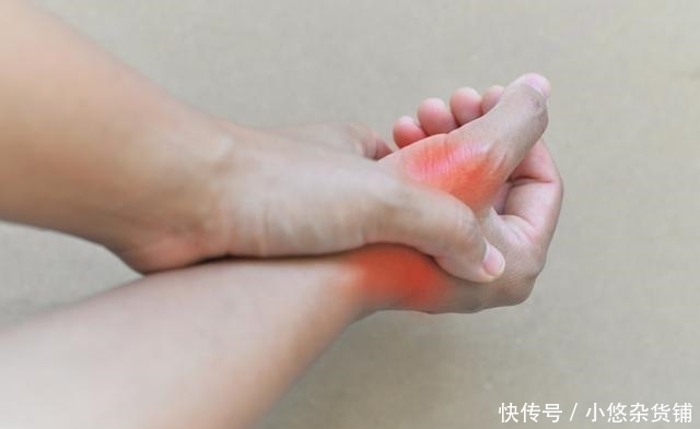  阶段|痛风分阶段，这4个阶段的痛风，你都了解吗？