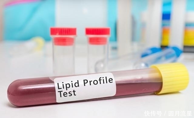 甘油三酯高|甘油三酯高是不是高血脂?医生告诉您不吃药怎么降甘油三酯?
