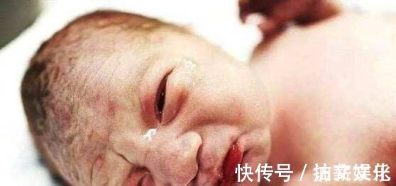 分泌物|宝宝出生时，有的睁开眼，有的闭上眼，哪种比较好医生说都好