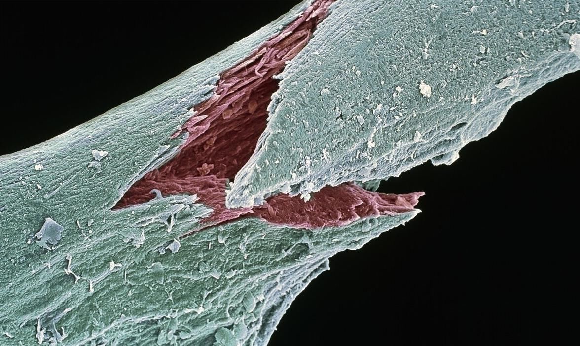 长寿秘诀|109岁人，年轻仅65岁，长寿秘诀不是多锻炼，而是这3件事