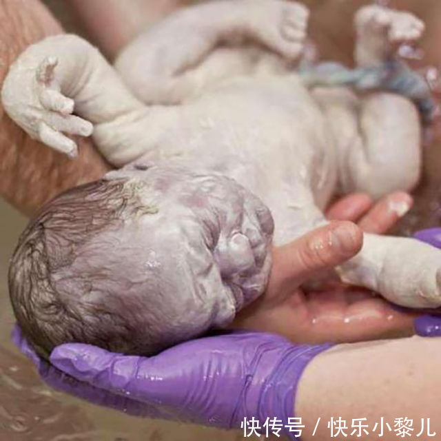 照片|宝妈吐槽自己生了一颗“猕猴桃”,晒出宝宝照片后,网友恍然大悟